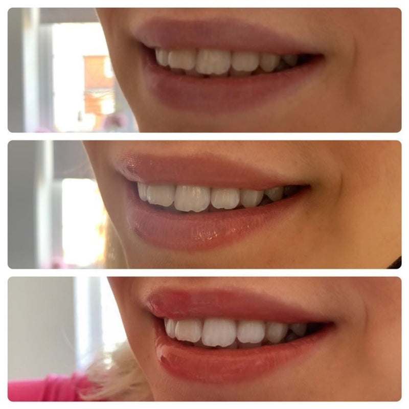 SmileTime Natural Charcoal Teeth Whitening Powder